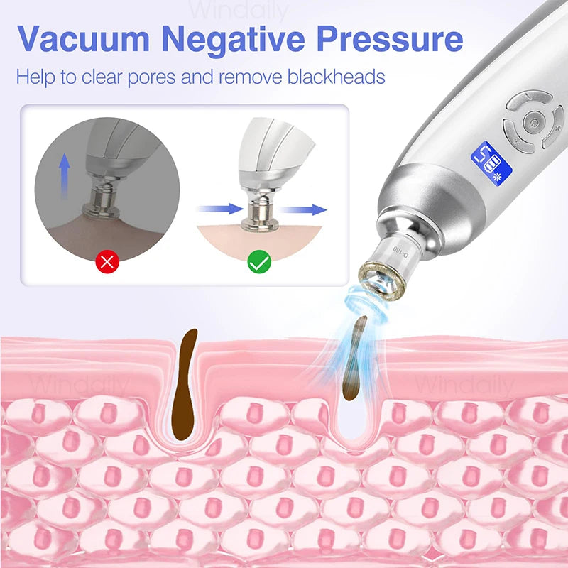 2025 Wireless Diamond Microdermabrasion Machine Blackhead Remover Vacuum Pore Cleaner Facial Skin Care Tool Face Beauty Device