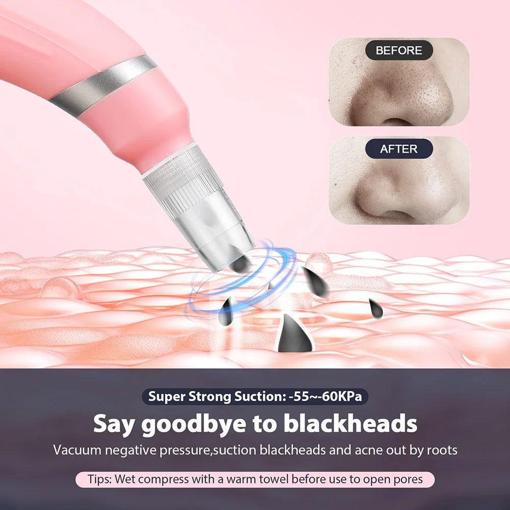 "Portable Diamond Microdermabrasion Vacuum- Blackhead Remover"