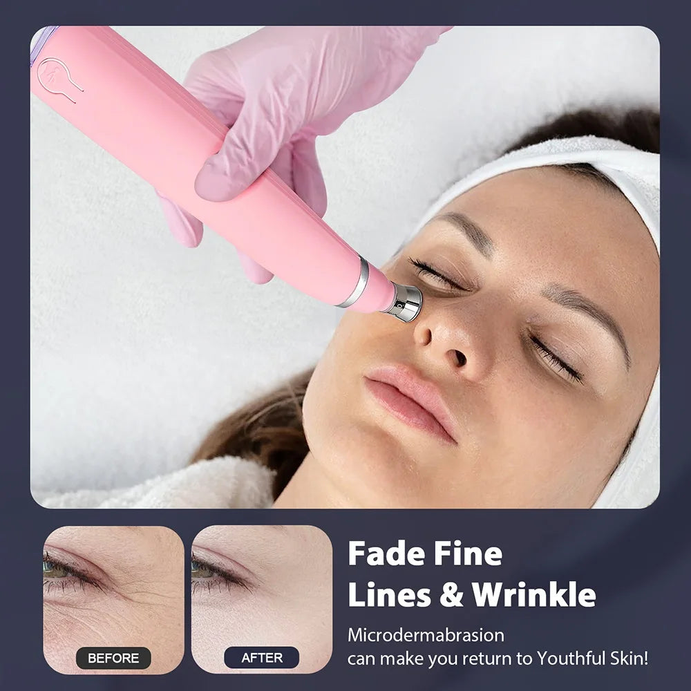 "Portable Diamond Microdermabrasion Vacuum- Blackhead Remover"